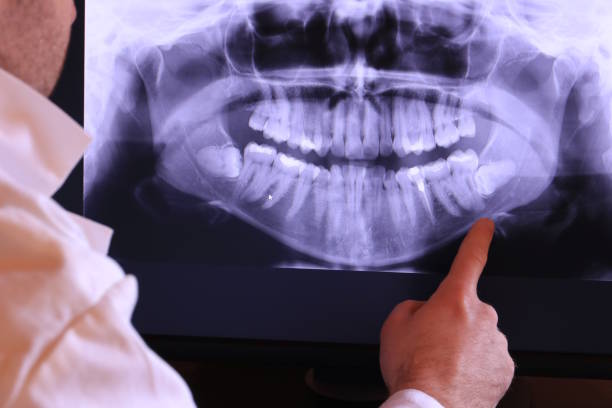 Best Emergency Root Canal Treatment in Homestead Meadows North, TX
