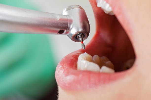 Best Pediatric Emergency Dentist in Homestead Meadows North, TX